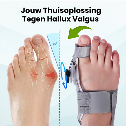ProAlign™ – Zachte Hallux Valgus Pijnverlichting En Correctie