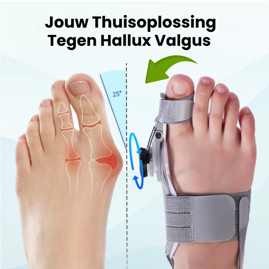 ProAlign™ – Zachte Hallux Valgus Pijnverlichting En Correctie