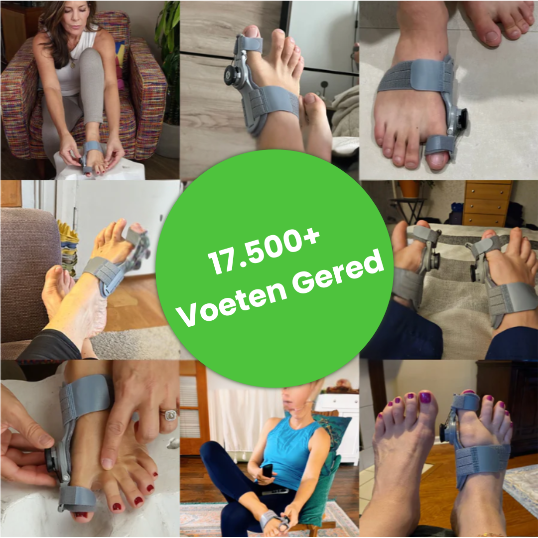 ProAlign™ – Zachte Hallux Valgus Pijnverlichting En Correctie